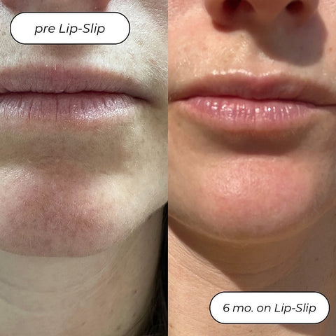 Lip-Slip